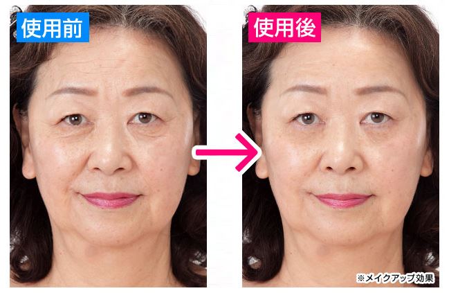 シワを伸ばすなら