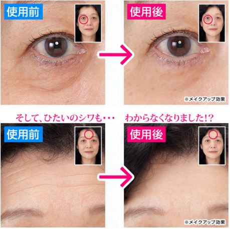 ウィンクルイージーサポートジェルEX