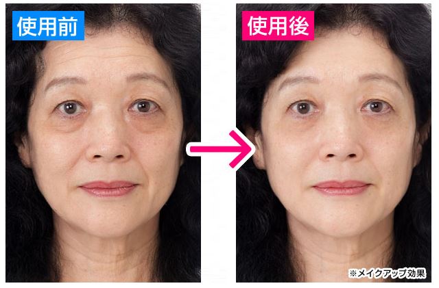 シワ,速攻.伸ばし,化粧品